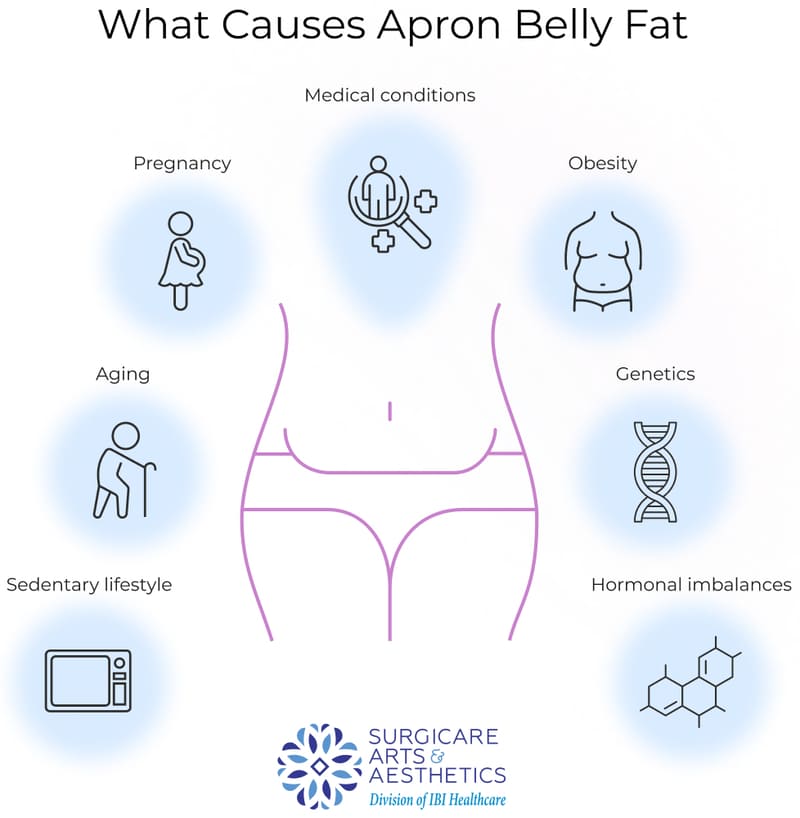 Apron Belly The Fastest Way To Remove It In 2022