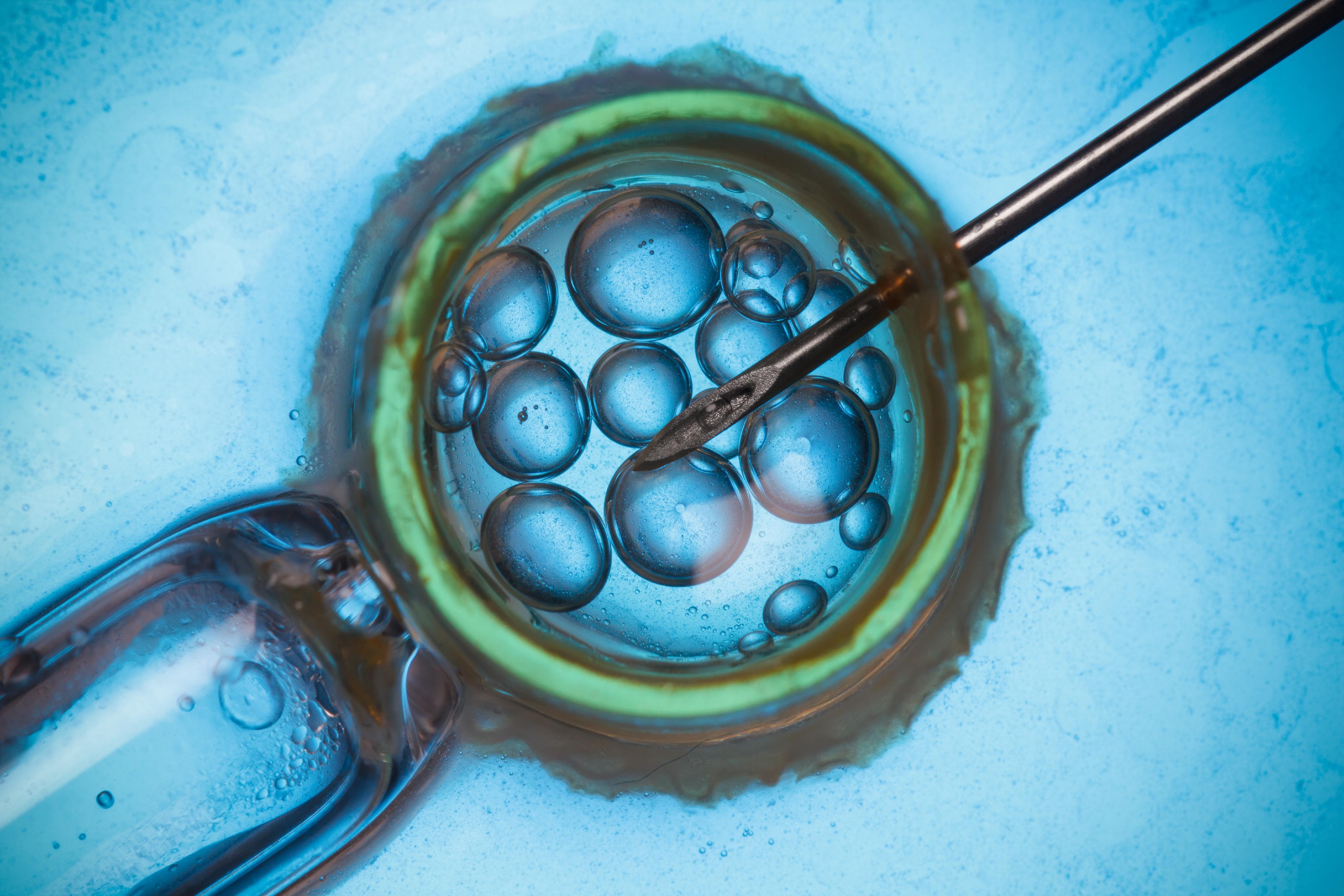 Assisted Reproductive Technology