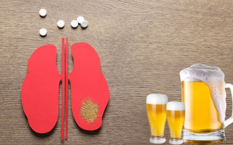 Beer For Kidney Stones Is It Safe Or Not Healthshots