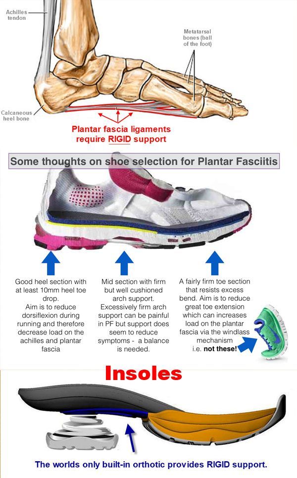 Best Shoes For Foot Pain All You Need Infos