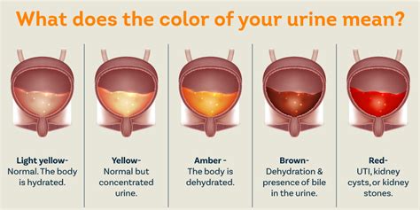 15+ Causes Of Blood In Urine: Essential Guide - Coe Psu