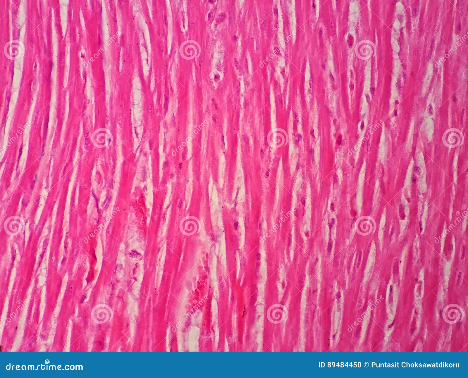 Cardiac Muscle Section Heart Muscle Myocardium Under Light Microscope