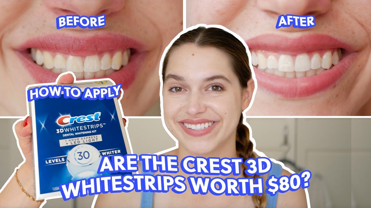 Crest 3D White Whitestrips Light Review 2024 Truth Revealed