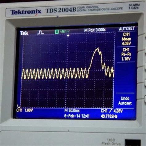 Mmg Sensor On Muscle - Coe Psu