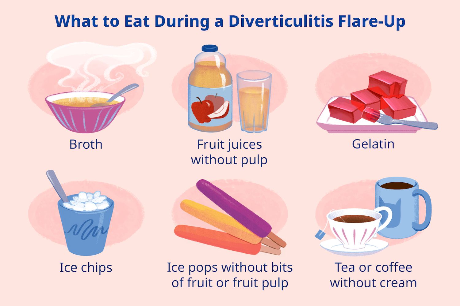 Diverticulitis Diet Image By Celeste Diverticulitis Diet