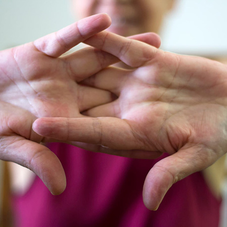 Does Cracking Knuckles Cause Arthritis Rio Grande Regional Hospital