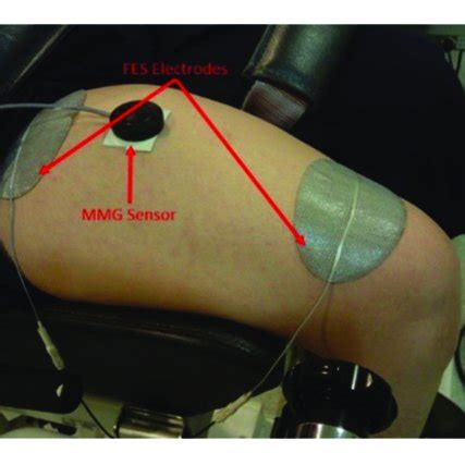 Mmg Sensor On Muscle - Coe Psu