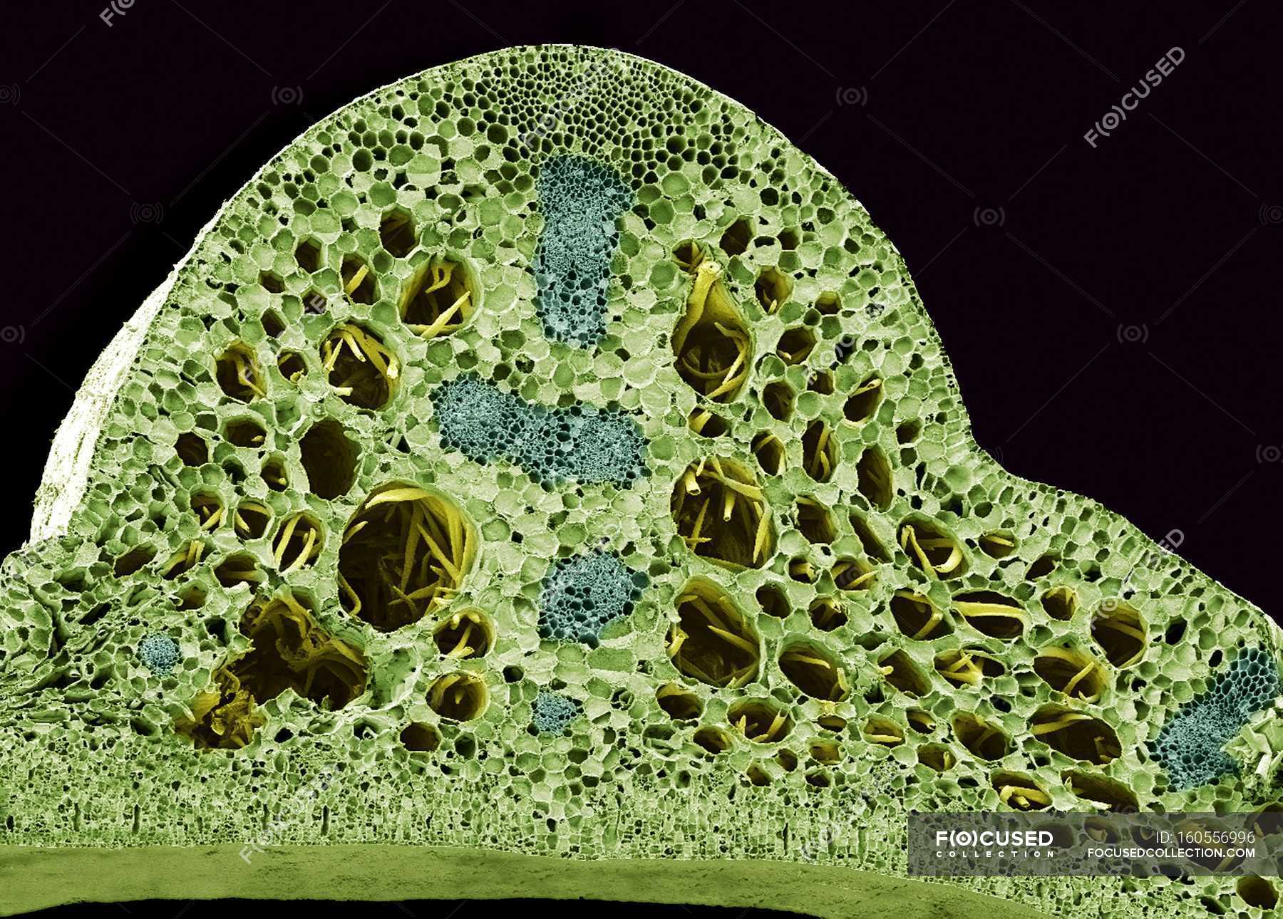 Gardnerella Vaginalis Coloured Scanning Electron Micrograph Sem Of A