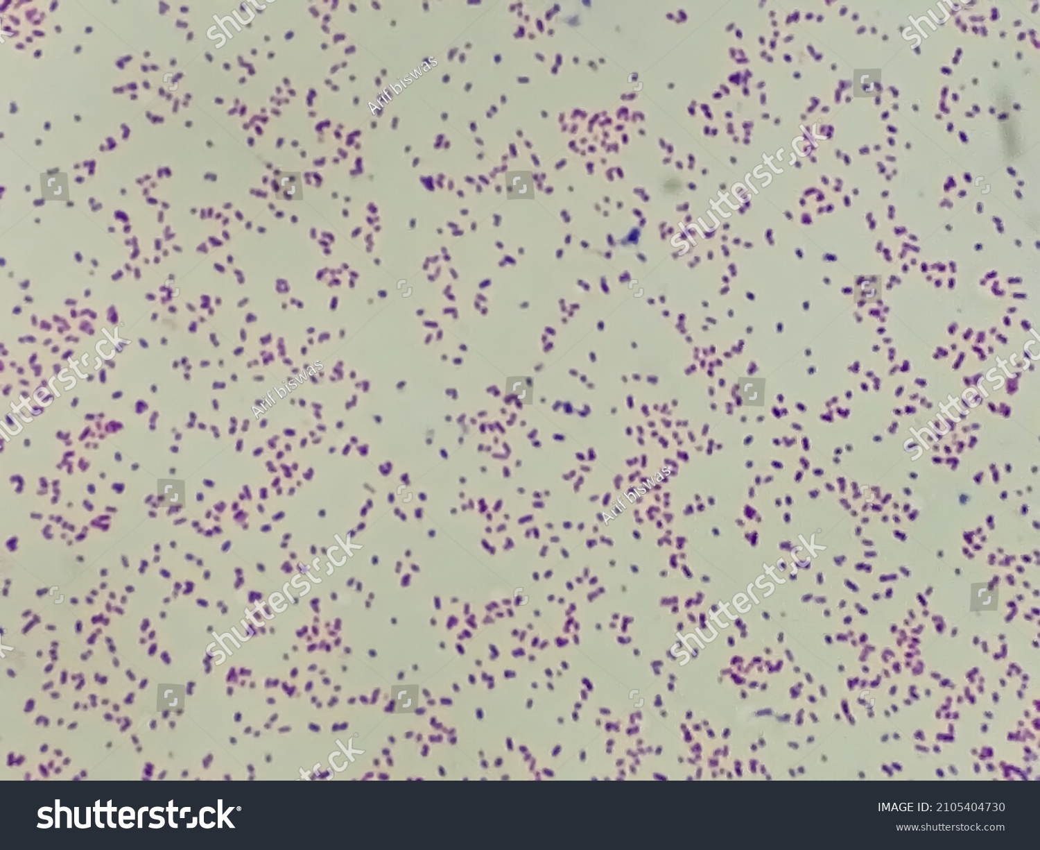 Gardnerella Vaginalis Infecci N Genital Vaginosis Bacteriana Foto De