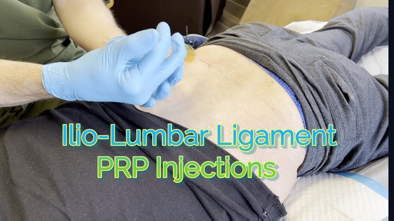 Iliolumbar Ligament Massage Lower Back Pain Relief Youtube