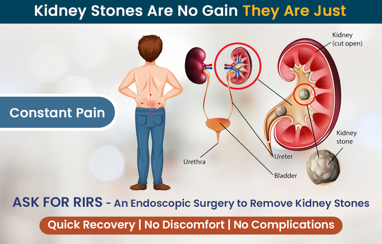 Kidney Pain Causes Treatment And When To See A Healthcare Provider