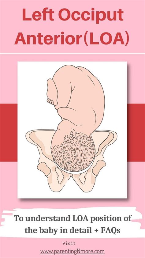 Loa Left Occipitoanterior Fetal Position