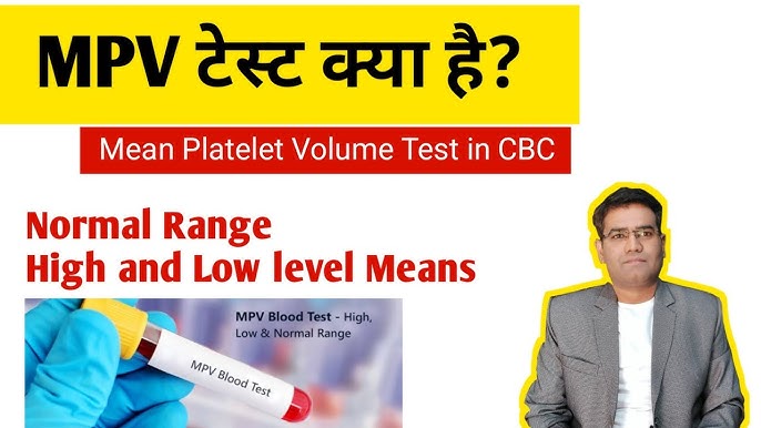 Mpv Blood Test Example Free Pdf Download