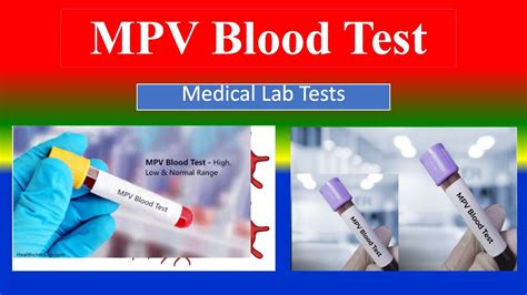 Mpv Blood Test Medical Lab Tests What Is Uses Need