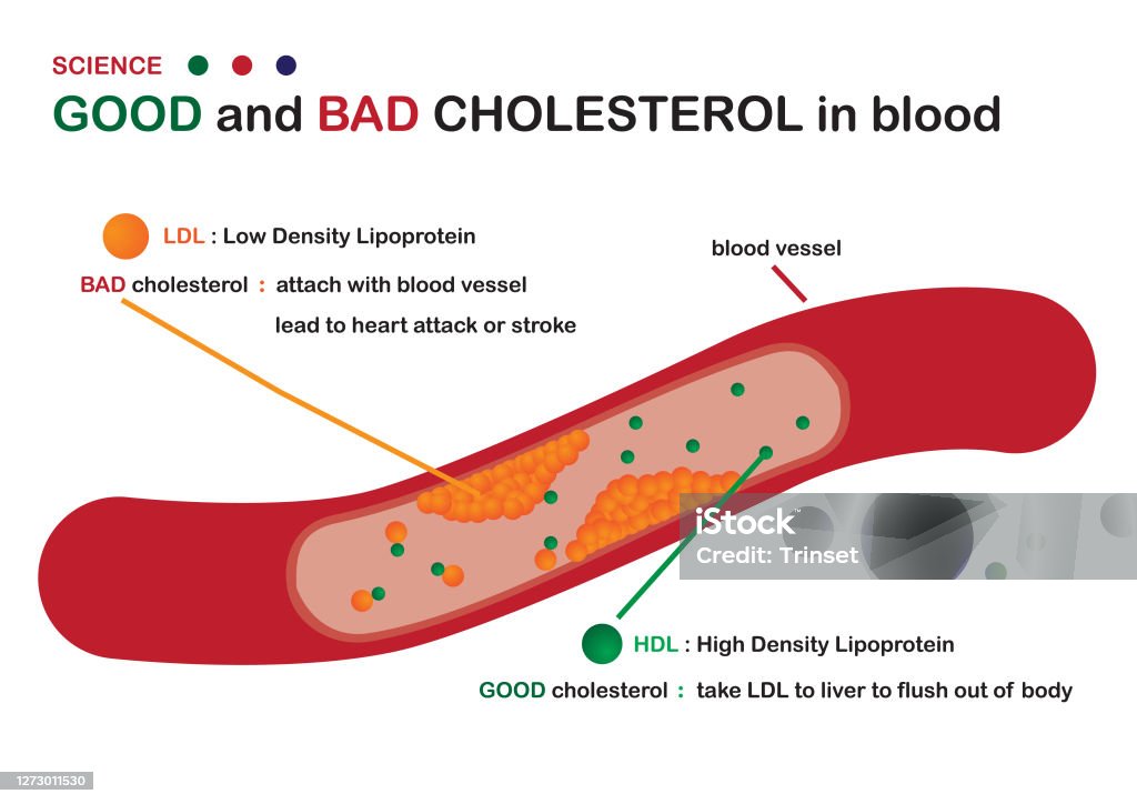 Pin On Statins Amp Bad Ldl