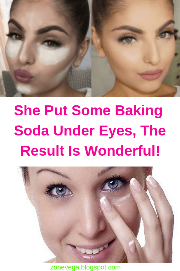 She Applied Yellow Baking Soda Under Eyes See Here What Happened Baking Soda Under Eyes