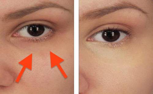 She Put Some Baking Soda Under Eyes The Result Is Wonderful By