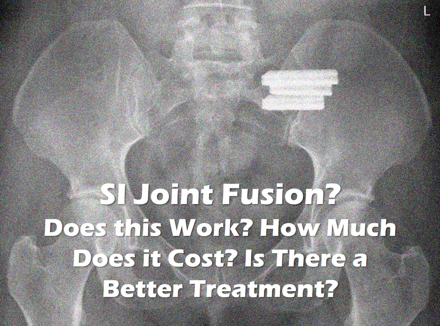 Si Joint Injection Side Effects - Coe Psu