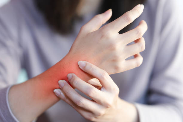 Speed Up Your Sprained Wrist Recovery Expert Tips For A Faster