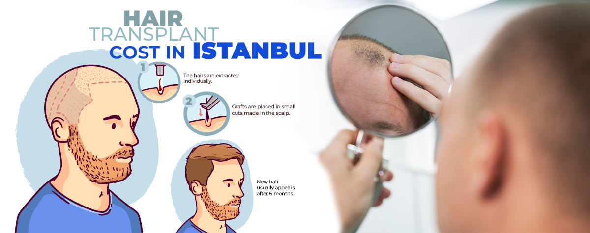 Turkey Hair Transplant Cost Universal Hair Transplant