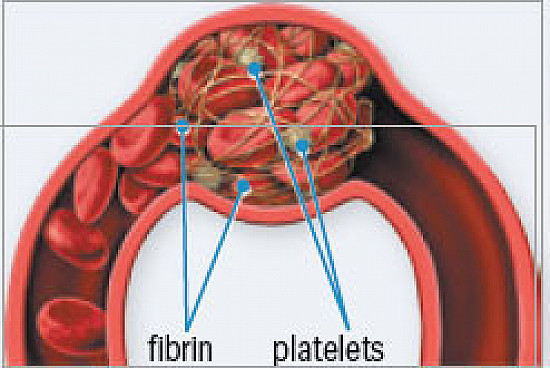 Understanding The Different Types Of Blood Thinners