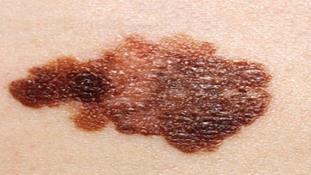 What Are The Most Common Skin Disorders