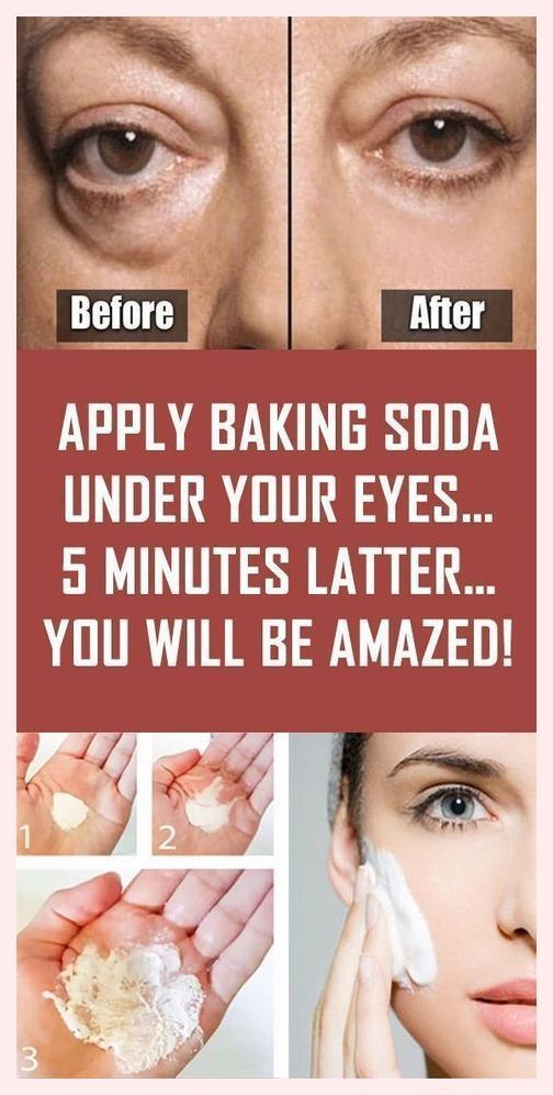 Why To Apply Baking Soda Under Your Eyes Baking Soda Under Eyes Face