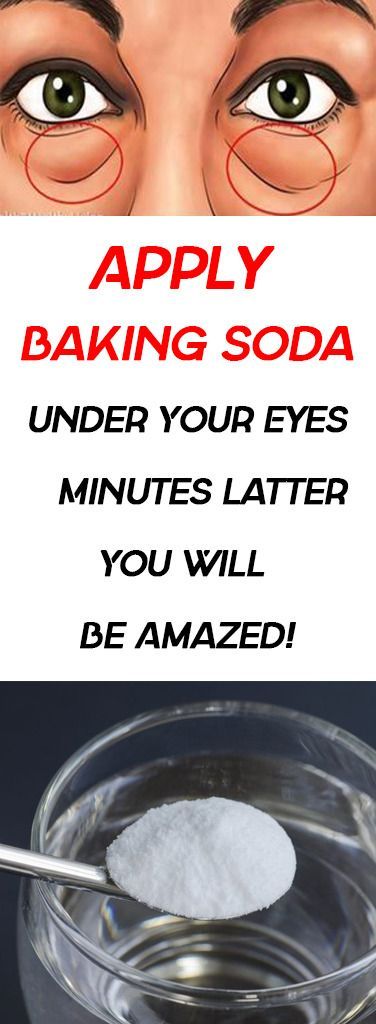 Why You Should Put Baking Soda Under Your Eyes Health Benefits Of Baking Soda For Eye Youtube