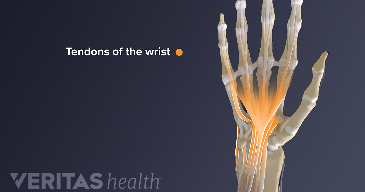 Wrist Tendonitis Vs Sprain Sports Health